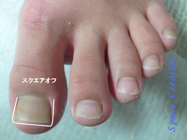 評価 厚い足の爪または成長した足の爪のための広い足の爪切り-握りやすい+革の包装 安全な保管のための大きなプロの足の爪切り長いハンド